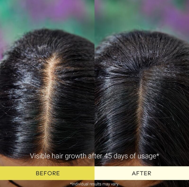Arata Grow+ Turmeric Hair Oil & Scalp Scrub Combo - Image 5