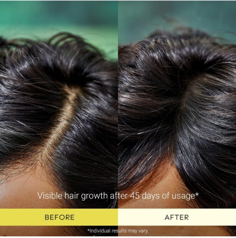 Arata Grow+ Turmeric Hair Oil & Scalp Scrub Combo - Image 6